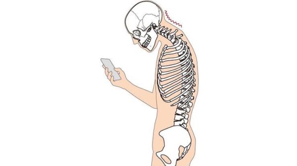 肩こりがクセになるストレートネックのデメリットと整骨院での改善法【西葛西・篠崎】